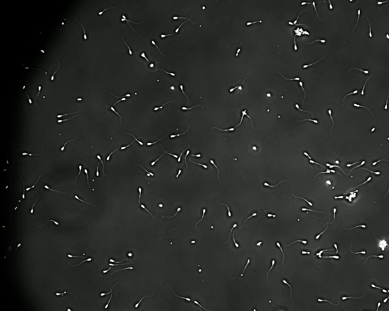 Real sperm image